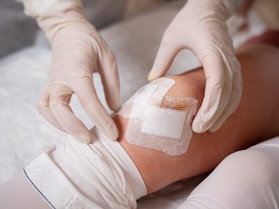 WOUND CARE SERVICES